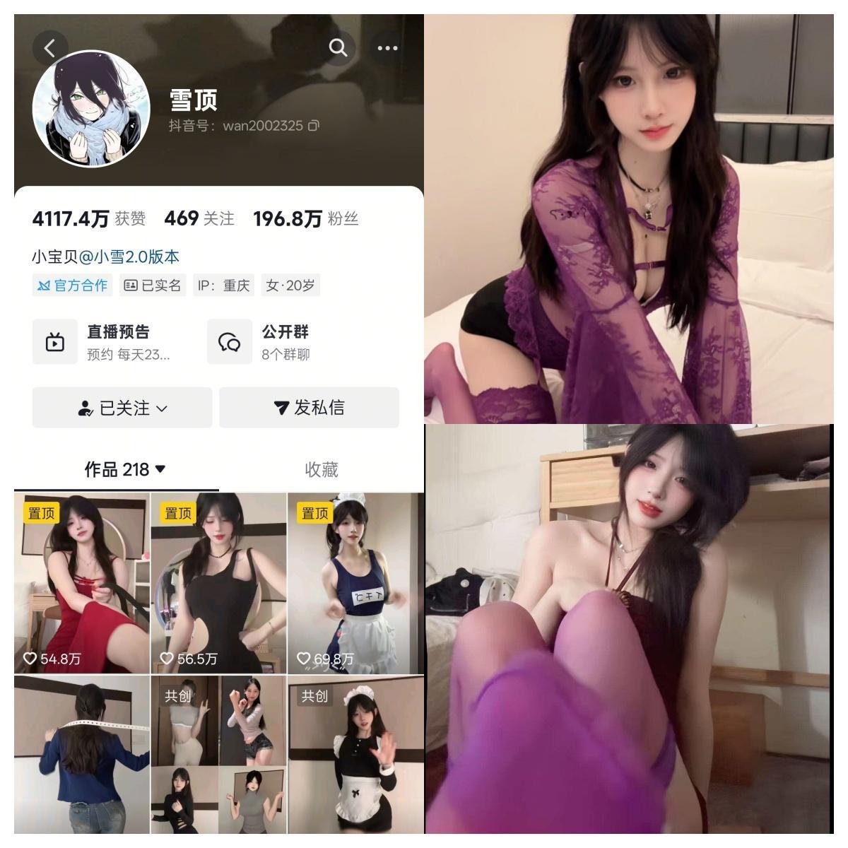 雪顶 合集-电鸽